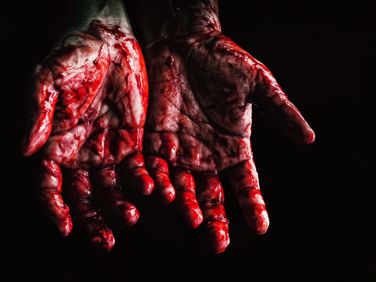 Alien Hand Syndrome: When Your Body Betrays You