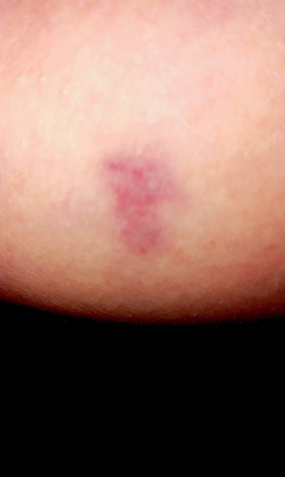 Winter-Crina DuBroc — Porphyria Mark.