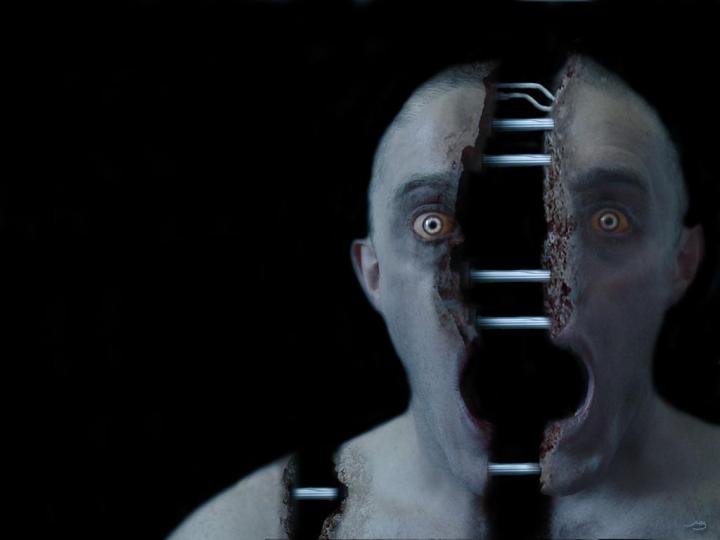 Schizophrenia - Mental Disorder